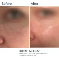 Ніжна пінка для вмивання з пребіотиками Braderm - Kurac Mousse 100 мл — Фото 7
