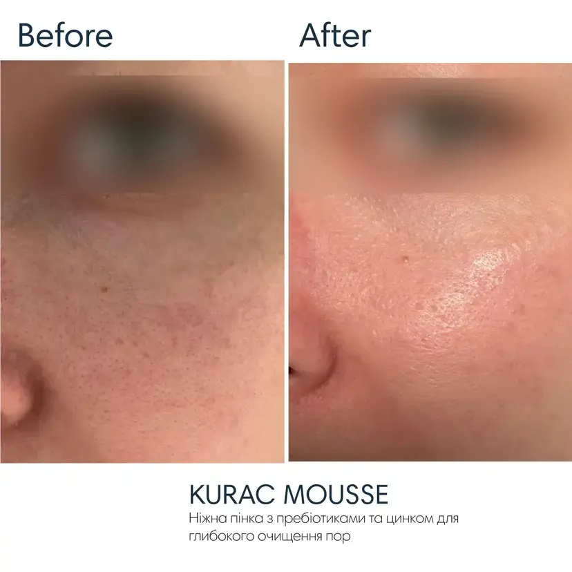 Ніжна пінка для вмивання з пребіотиками Braderm - Kurac Mousse 100 мл — Фото 1