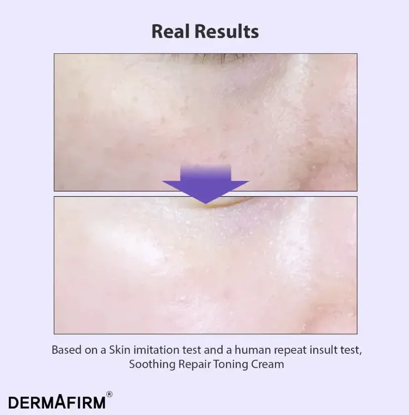 Тонізуючий крем з глутатіоном та бакучіолом Dermafirm Soothing Repair Toning Cream R4 50g — Фото 1