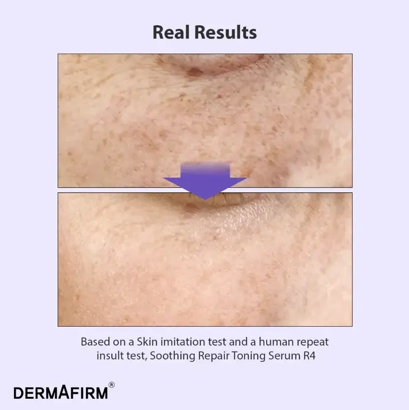 Мультифункціональна сироватка з бакучіолом Dermafirm Soothing Repair Toning Serum R4 30 ml — Фото 4